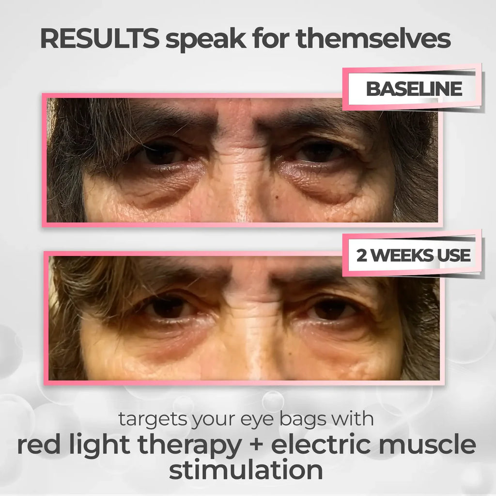 Eye Massager Device