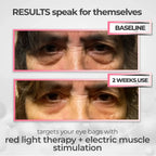 Eye Massager Device