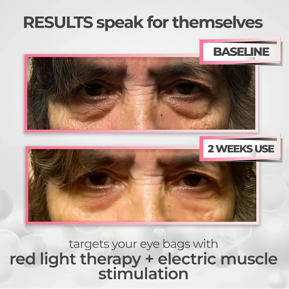 Eye Massager Device