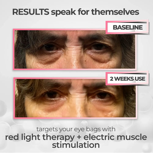 Eye Massager Device